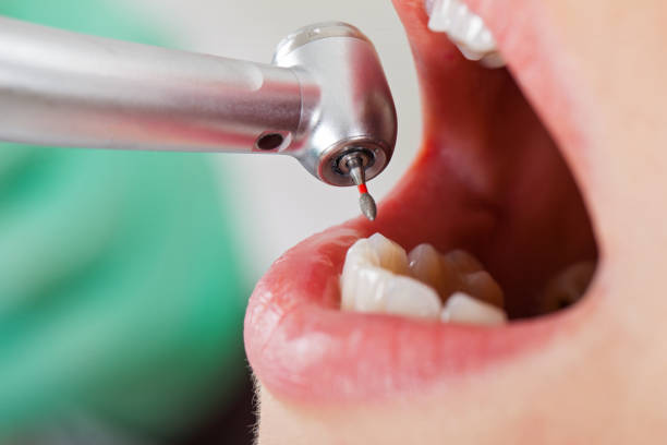 Best Dentist for Tooth Abscess  in Dunlap, IL